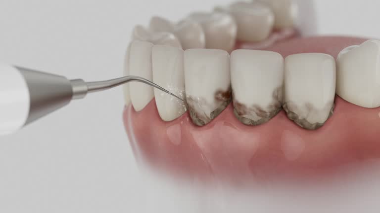 Reliable Dental Implants contractor in Manchester, NH by Smile Center Dentistry